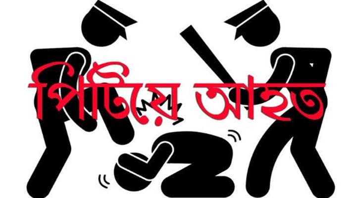 টর্চের আলো চোখে পড়ায় পুলিশ কনস্টেবল ও তার পরিবারের সদস্যদের পিটিয়ে আহত