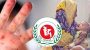 হামের উপসর্গে আরও তিনজনের মৃত্যু