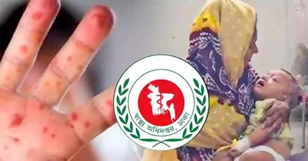 হামের উপসর্গে আরও তিনজনের মৃত্যু