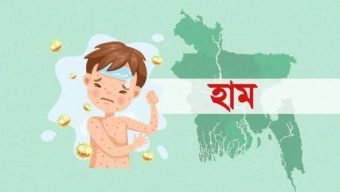 দেশে হামের উপসর্গ নিয়ে আরও আট শিশুর মৃত্যু