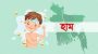 দেশে হামের উপসর্গ নিয়ে আরও আট শিশুর মৃত্যু